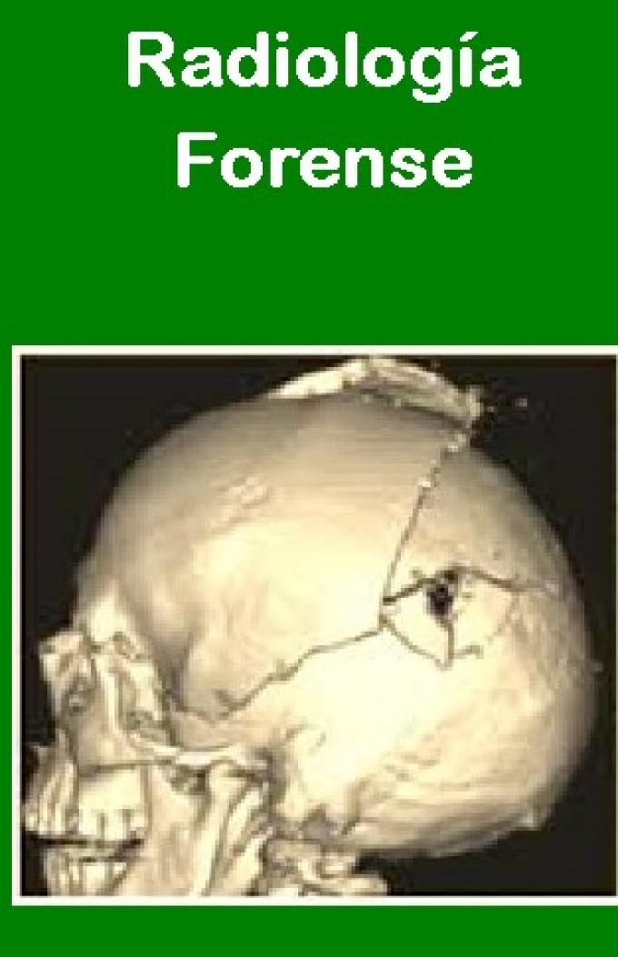 Radiologia Forense
