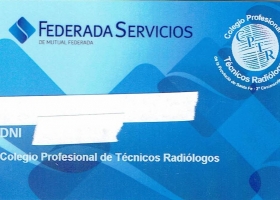 BENEFICIOS FEDERADA